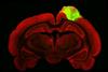 Low-Res_Histological image of a rat brain with a grafted human brain organoid CREDIT Jgamadze et al..jpg