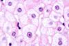 Liver,Cells,(hepatocytes),Seen,With,The,Light,Microscope.,Their,Nuclei
