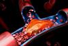 organ-on-a-chip-thrombosis-image