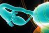 ovarian-cancer-3-1