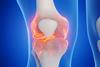 3d,Rendered,Medical,Illustration,Of,A,Man's,Knee.,Blue,Background.
