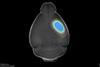 Low-Res_2026-07-29-SPAN-Lesion-Data-For-Jim_composite_V4__0005