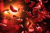 sickle-anaemia-image