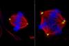 Low-Res_mittal_abnormal_cell_division