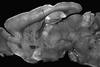 Low-Res_Syngap1 brain for Article