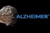 Deteriorating,Brain,Model,With,"alzheimer's",Text,,Depicting,Neurodegenerative,Condition,And