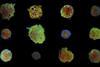 cell painting_uppsala_university_3D_cancer_cell_clusters