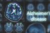 Alzheimer's-disease-image