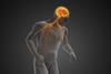 Neurodegenerative,Disorder,With,Motor,Dysfunction,Or,Parkinson's,Disease,3d,Illustration