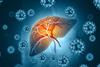 liver-disease-image