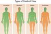 Forms,Of,Cerebral,Palsy,Illustrated,In,Medical,Diagram.