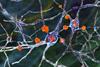 Neuronal,Inclusions,In,Huntington's,Disease,,3d,Illustration.,Inclusions,Are,Composed