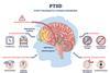 Ptsd,Brief,Diagram,Shows,Trauma,S,Effects,On,The,Brain,