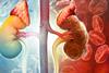 Chronic,Kidney,Disease.,3d,Illustration