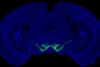 Low-Res_Dopamine Parkinsons pic (1)