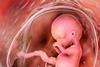 Human,Fetus,In,The,Uterus,,Scientifically,Accurate,3d,Illustration.,Early