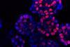 Low-Res_Leberkrebs-Organoide 1000x500