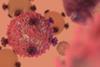 T,Cell,Lymphocyte,With,Receptors,To,Kill,Cancer,Cells,In