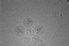 Several,Nanoparticles,Made,Of,Lipids,Containing,An,Anticancer,Drug,Modern