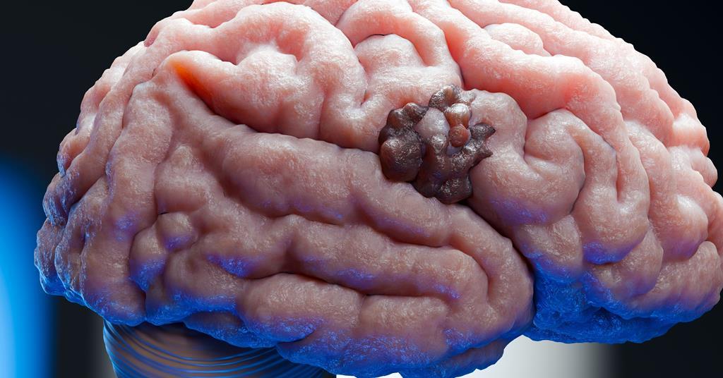 SIRPα 揭示了乳腺癌如何在大脑中占据一席之地