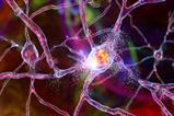 Destruction,Of,Neurons,Of,Dorsal,Striatum,,Conceptual,3d,Illustration.,Dorsal