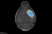 Low-Res_2026-07-29-SPAN-Lesion-Data-For-Jim_composite_V4__0005