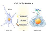 Cellular,Senescence,Process.,Normal,Fibroblast,And,Senescent,Cell.,Signs,Of