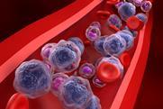 Acute,Myeloid,Leukemia,(aml),Cells,In,Blood,Flow,-,Closeup