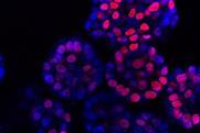 Low-Res_Leberkrebs-Organoide 1000x500