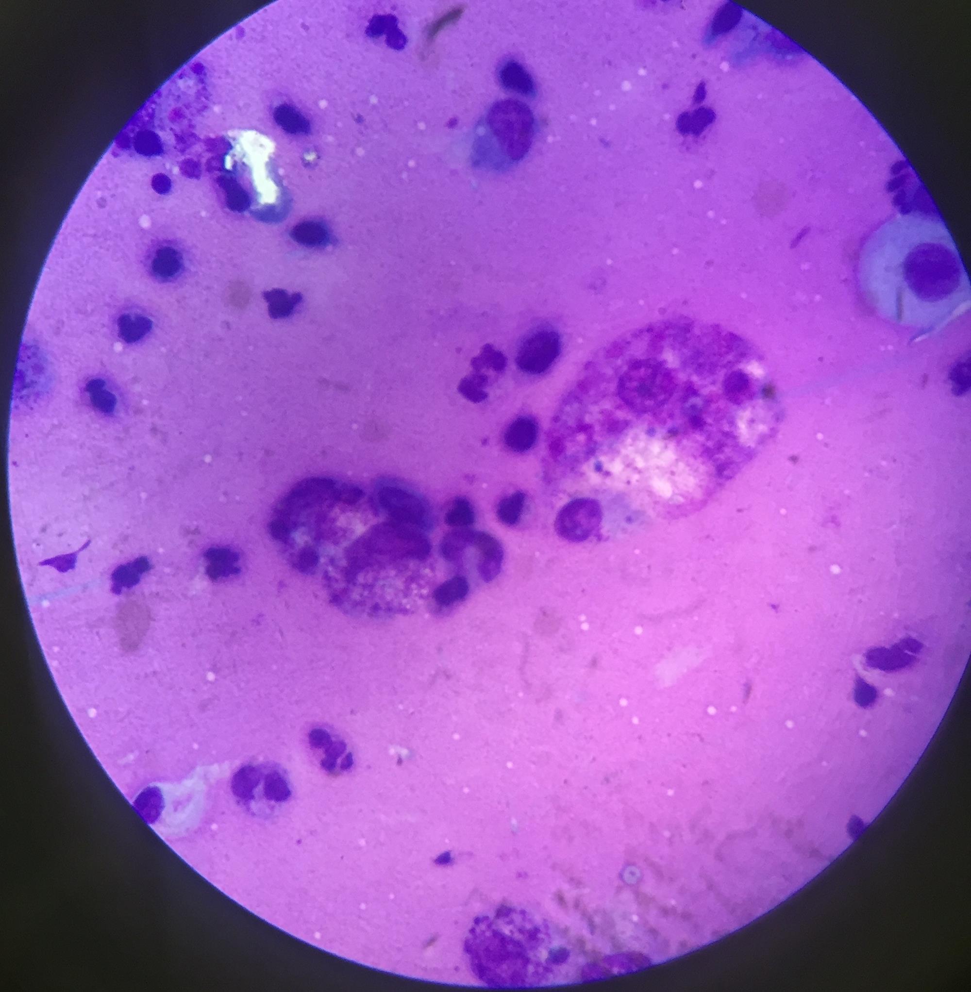 Macrophage phenotype insights could improve immunotherapy | News