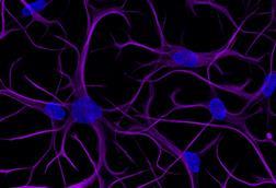 ioAstrocyte - Hero image 20x