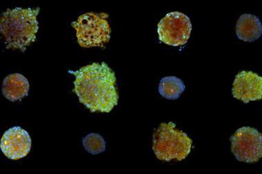 cell painting_uppsala_university_3D_cancer_cell_clusters