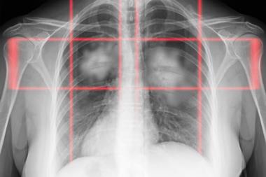 shutterstock_2437936285