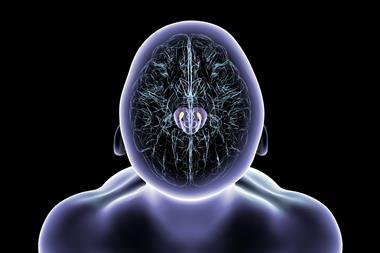 Human,Brain,With,Degenerated,Substantia,Nigra,In,Parkinson's,Disease,,Showing