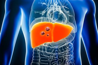 Liver,Cancer,With,Organs,And,Tumors,Or,Cancerous,Cells,3d