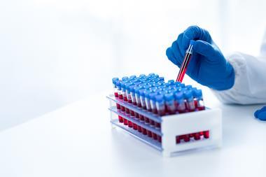 Doctor,Hand,Taking,A,Blood,Sample,Tube,From,A,Rack