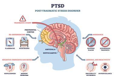 Ptsd,Brief,Diagram,Shows,Trauma,S,Effects,On,The,Brain,