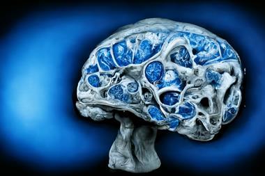 Brain,Atrophy,,Brain,Degeneration,Due,To,Aging,,Ageing,Brain,,Multiple