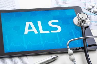 The,Word,Als,On,The,Display,Of,A,Tablet