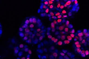 Low-Res_Leberkrebs-Organoide 1000x500