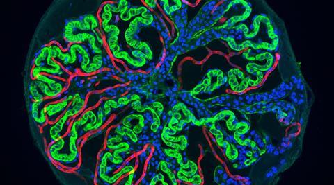 Fluorescence microscopy image of a kidney organoid showing tubular structures and branching morphogenesis.