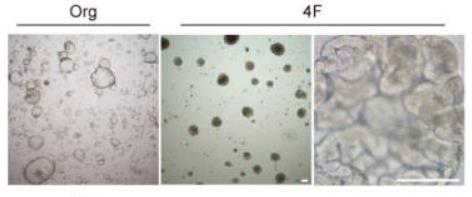 Three microscopy images comparing organoid cultures labelled Org and 4F, showing differences in organoid size, shape and cellular structures.