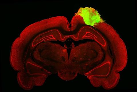 Low-Res_Histological image of a rat brain with a grafted human brain organoid CREDIT Jgamadze et al..jpg