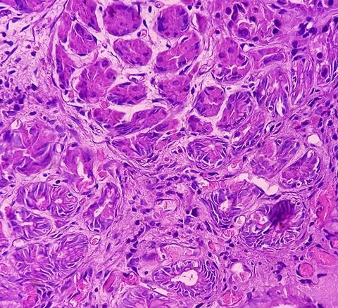 Gastric,Body,Tissue,(endoscopic,Biopsy):,Section,Show,Gastric,Mucosa,,Features