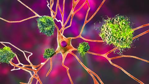 Neurons,In,Alzheimer's,Disease.,3d,Illustration,Showing,Amyloid,Plaques,In
