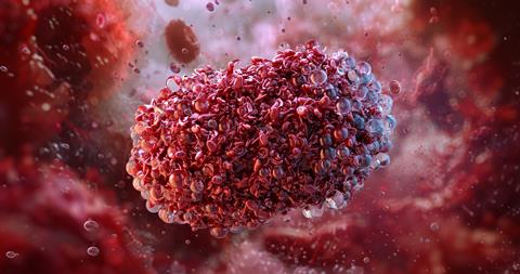 Monkeypox,Virus,,A,Zoonotic,Orthopoxvirus,Causing,A,Smallpox,Illness.,Viral