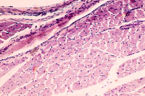 Cross,Section,Of,Muscle,Skeletal,Under,The,Microscope