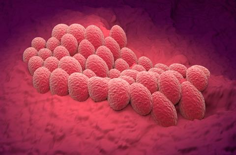 Endometrial,Cancer,Cells,(adenocarcinoma),In,The,Uterus,Or,Cervix,(womb