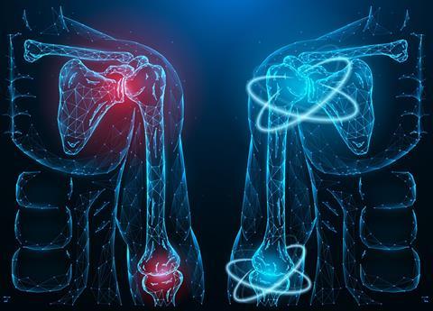 Polygonal,Vector,Illustration,Of,A,Diseased,Inflamed,Human,Shoulder,And