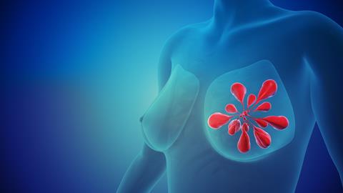 Conceptual,Visualization,Of,Breast,Cancer,3d,Illustration